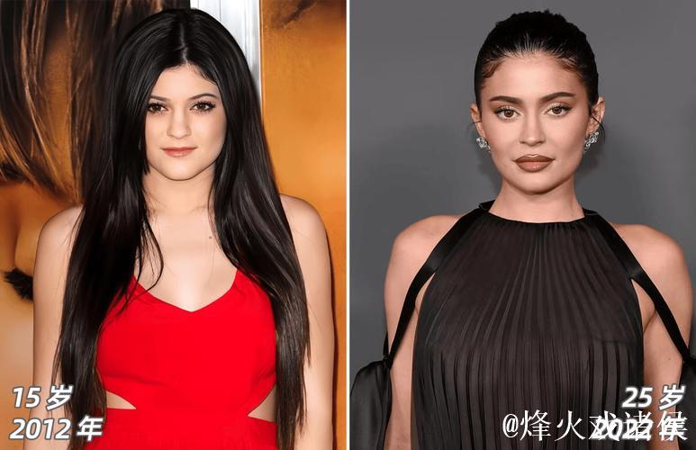 加盟枪手前焦虑困扰凯莉，深受脱发影响