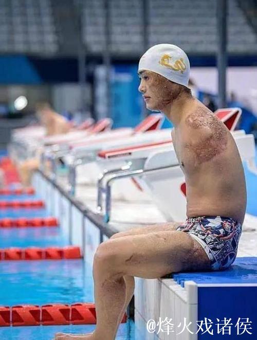 残特奥会聚焦｜“无臂飞鱼”袁伟译：跨越人生新起点